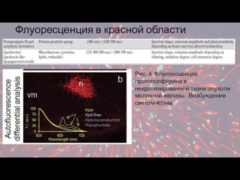 Флуоресценция в красной области спектра Рис. 4. Флуоресценция протопорфирина в некротизированной ткани опухоли