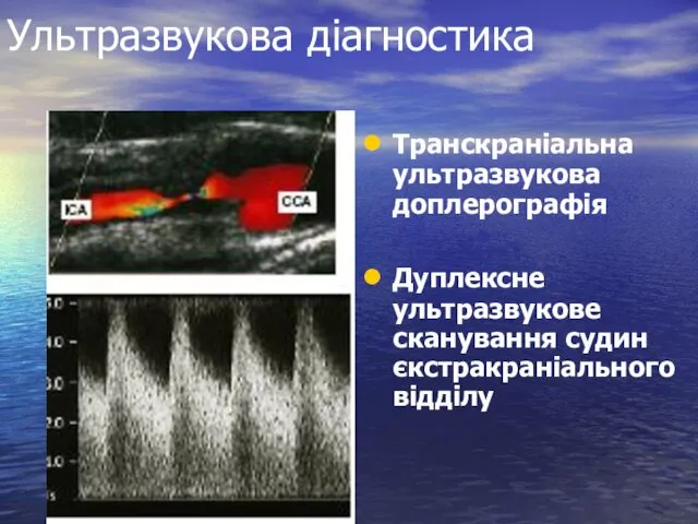 Ультразвукова діагностика Транскраніальна ультразвукова доплерографія Дуплексне ультразвукове сканування судин єкстракраніального відділу