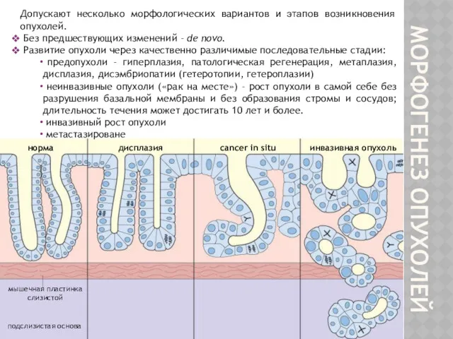 МОРФОГЕНЕЗ ОПУХОЛЕЙ Допускают несколько морфологических вариантов и этапов возникновения опухолей.