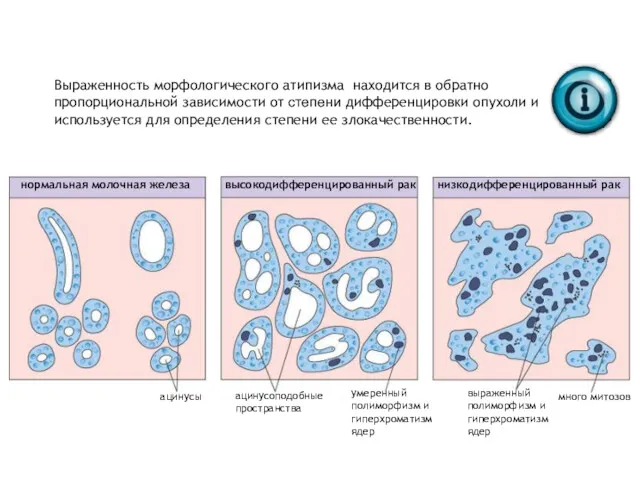 Выраженность морфологического атипизма находится в обратно пропорциональной зависимости от степени