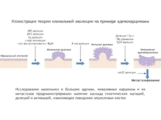 Иллюстрация теории клональной эволюции на примере аденокарциномы Нормальный эпителий Маленькая