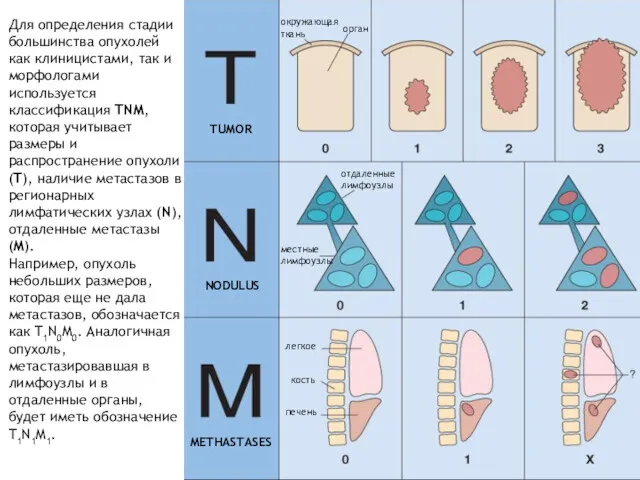 TUMOR NODULUS METHASTASES окружающая ткань орган отдаленные лимфоузлы местные лимфоузлы