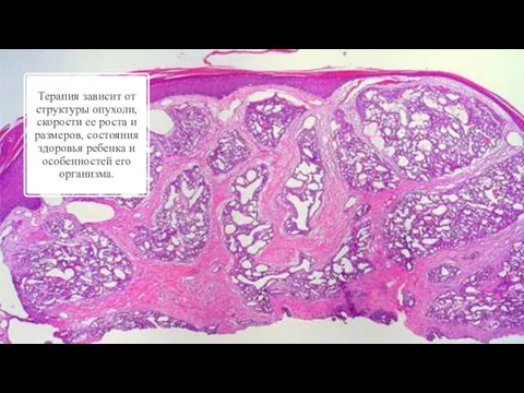 Терапия зависит от структуры опухоли, скорости ее роста и размеров,