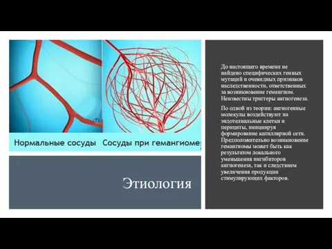 Этиология До настоящего времени не найдено специфических генных мутаций и