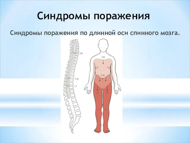 Синдромы поражения Синдромы поражения по длинной оси спинного мозга.