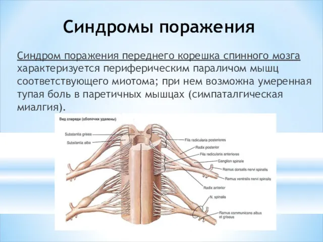 Синдромы поражения Синдром поражения переднего корешка спинного мозга характеризуется перифе­рическим