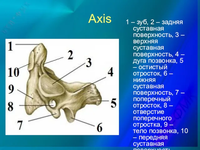 Axis 1 – зуб, 2 – задняя суставная поверхность, 3