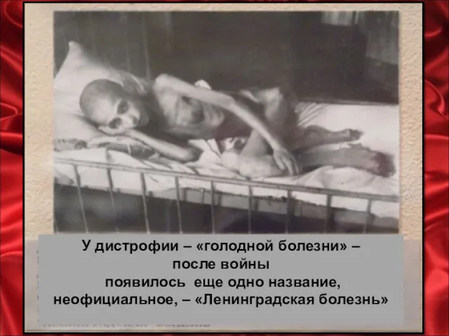 У дистрофии – «голодной болезни» – после войны появилось еще одно название, неофициальное, – «Ленинградская болезнь»