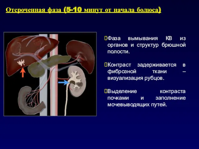 Отсроченная фаза (5-10 минут от начала болюса) Фаза вымывания КВ