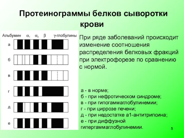 Протеинограммы белков сыворотки крови а - в норме; б -