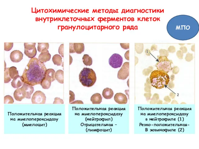Цитохимические методы диагностики внутриклеточных ферментов клеток гранулоцитарного ряда Положительная реакция на миелопероксидазу (миелоцит)