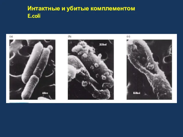 Интактные и убитые комплементом E.coli