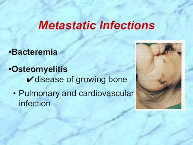 Metastatic Infections Bacteremia Osteomyelitis ✔disease of growing bone Pulmonary and cardiovascular infection