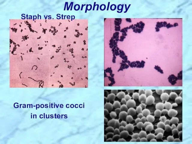 Morphology Staph vs. Strep Gram-positive cocci in clusters