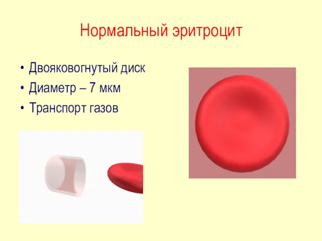 Нормальный эритроцит Двояковогнутый диск Диаметр – 7 мкм Транспорт газов