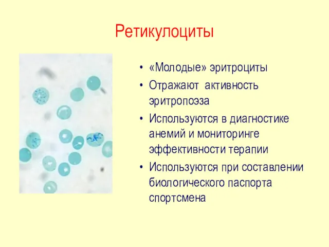 Ретикулоциты «Молодые» эритроциты Отражают активность эритропоэза Используются в диагностике анемий