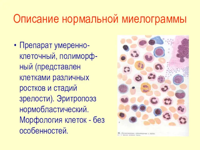 Описание нормальной миелограммы Препарат умеренно-клеточный, полиморф-ный (представлен клетками различных ростков