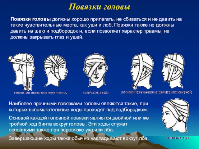 Повязки головы Повязки головы должны хорошо прилегать, не сбиваться и