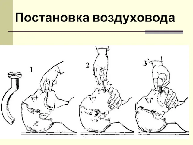 Постановка воздуховода