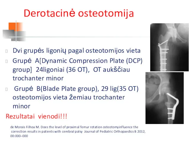 Derotacinė osteotomija Dvi grupės ligonių pagal osteotomijos vieta Grupė A[Dynamic