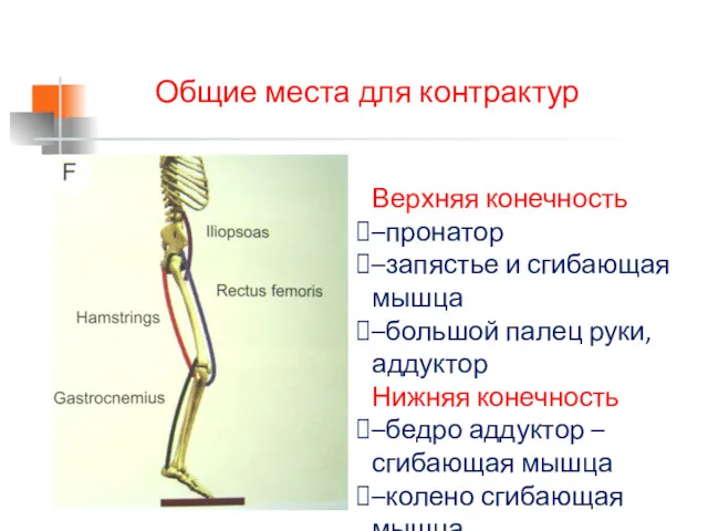 Верхняя конечность –пронатор –запястье и сгибающая мышца –большой палец руки,