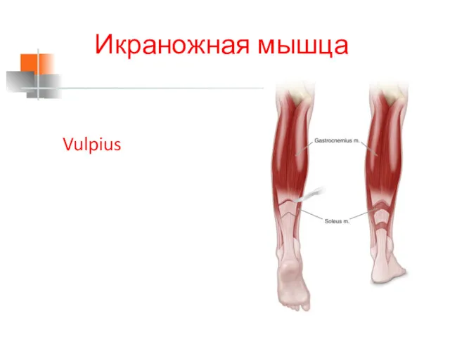 Икраножная мышца Vulpius