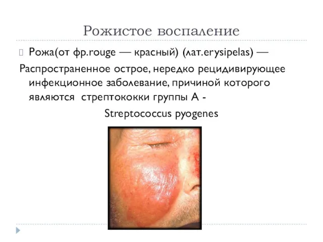 Рожистое воспаление Рожа(от фр.rouge — красный) (лат.erysipelas) — Распространенное острое,
