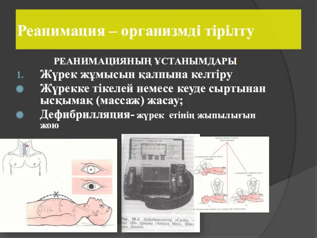 Реанимация – организмді тірілту РЕАНИМАЦИЯНЫҢ ҰСТАНЫМДАРЫ: Жүрек жұмысын қалпына келтіру