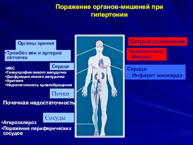 Поражение органов-мишеней при гипертонии Органы зрения Тромбоз вен и артерий