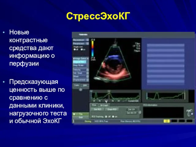 СтрессЭхоКГ Новые контрастные средства дают информацию о перфузии Предсказующая ценность