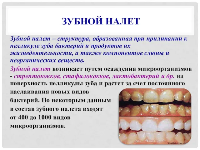 ЗУБНОЙ НАЛЕТ Зубной налет – структура, образованная при прилипании к