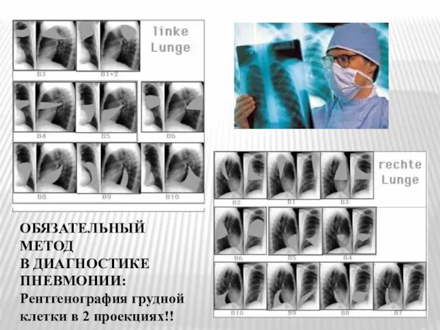 ОБЯЗАТЕЛЬНЫЙ МЕТОД В ДИАГНОСТИКЕ ПНЕВМОНИИ: Рентгенография грудной клетки в 2 проекциях!!