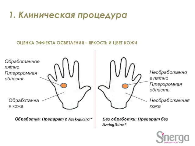 ОЦЕНКА ЭФФЕКТА ОСВЕТЛЕНИЯ – ЯРКОСТЬ И ЦВЕТ КОЖИ Обработка: Препарат