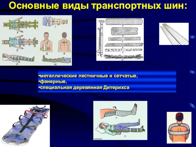 Основные виды транспортных шин: металлические лестничные и сетчатые, фанерные, специальная деревянная Дитерихса