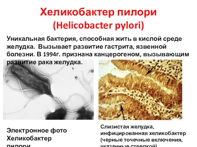 Хеликобактер пилори (Helicobacter pylori) Уникальная бактерия, способная жить в кислой