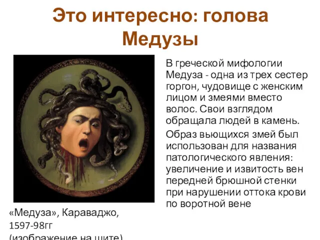 Это интересно: голова Медузы В греческой мифологии Медуза - одна