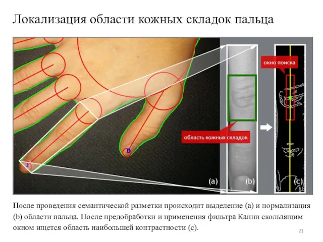 Локализация области кожных складок пальца После проведения семантической разметки происходит