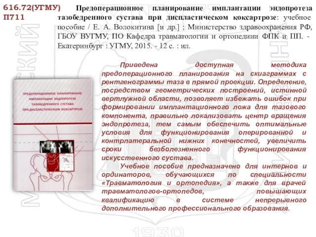 Приведена доступная методика предоперационного планирования на скиаграммах с рентгенограммы таза