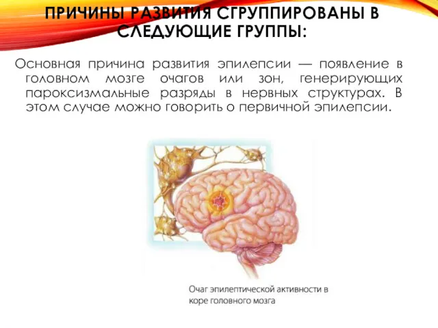 ПРИЧИНЫ РАЗВИТИЯ СГРУППИРОВАНЫ В СЛЕДУЮЩИЕ ГРУППЫ: Основная причина развития эпилепсии