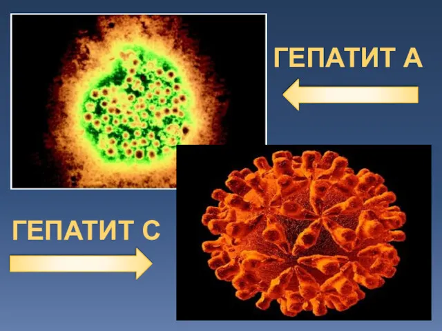 ГЕПАТИТ А ГЕПАТИТ С