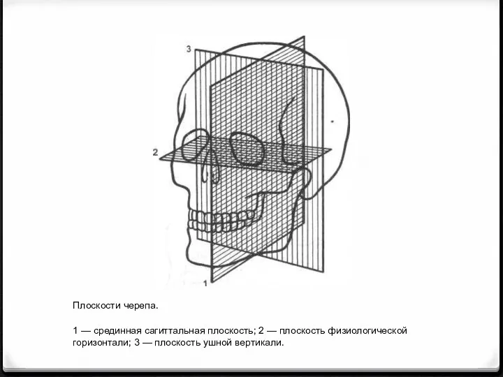 Плоскости черепа. 1 — срединная сагиттальная плоскость; 2 — плоскость