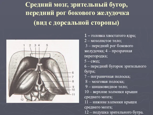 Средний мозг, зрительный бугор, передний рог бокового желудочка (вид с