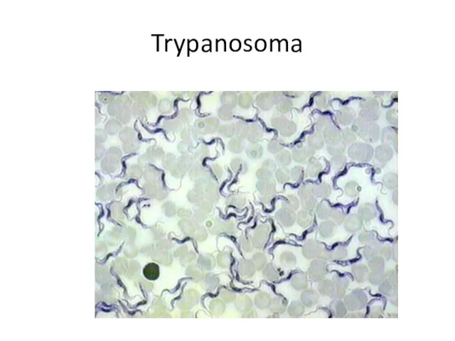 Trypanosoma