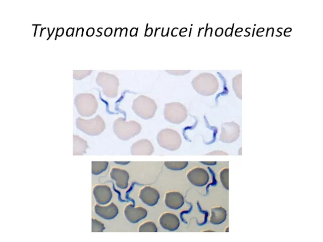 Trypanosoma brucei rhodesiense