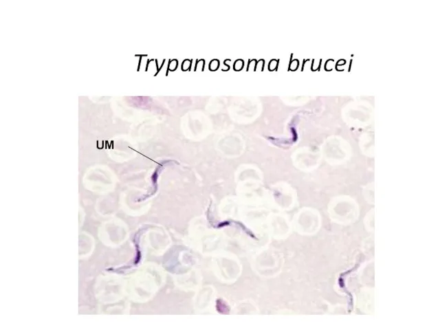 Trypanosoma brucei UM