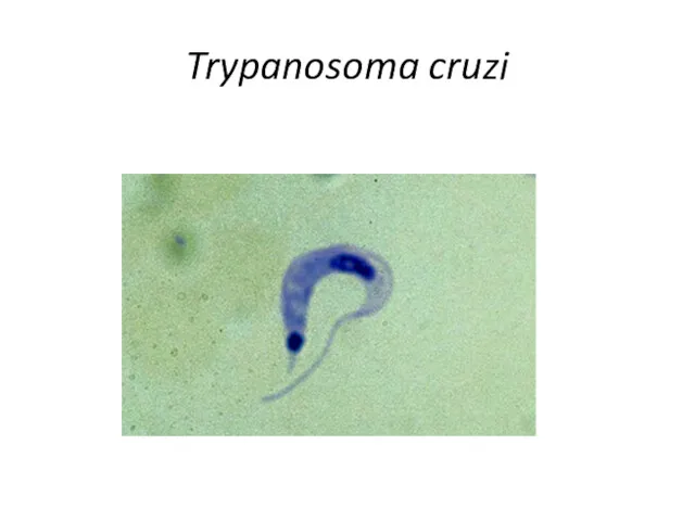 Trypanosoma cruzi