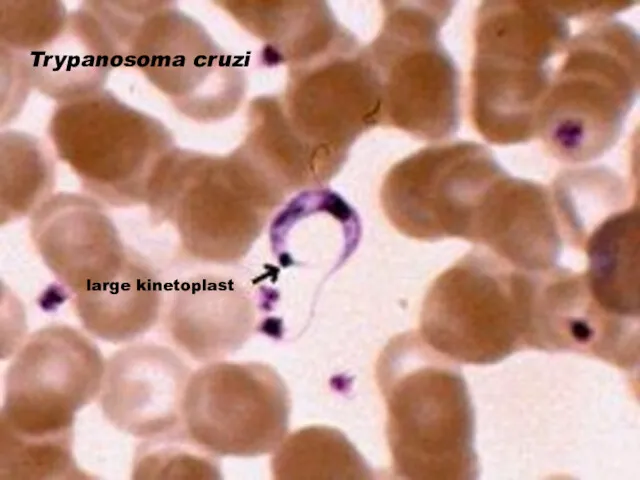 Trypanosoma cruzi large kinetoplast