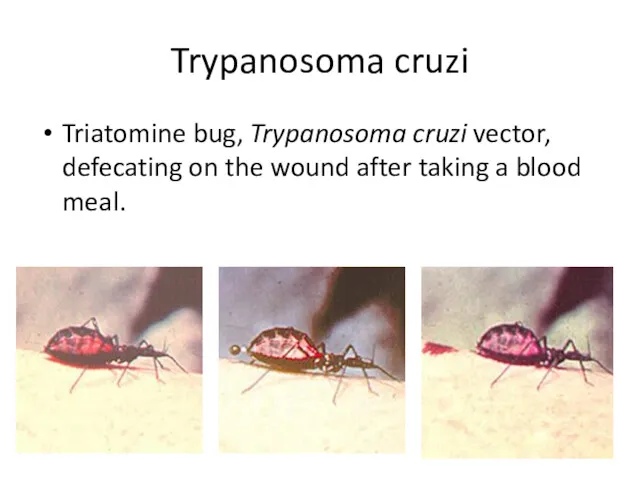 Trypanosoma cruzi Triatomine bug, Trypanosoma cruzi vector, defecating on the wound after taking a blood meal.