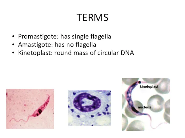 TERMS Promastigote: has single flagella Amastigote: has no flagella Kinetoplast: round mass of circular DNA