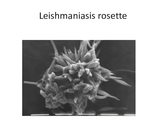 Leishmaniasis rosette